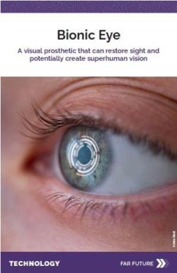 Changing Brains Neuro Futures Card - Bionic Eye.jpg